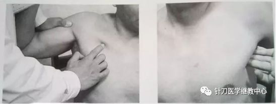 外展枕怎么使用干货 ｜ 针刀治疗要点规程定点定位_https://www.jmylbn.com_新闻资讯_第37张