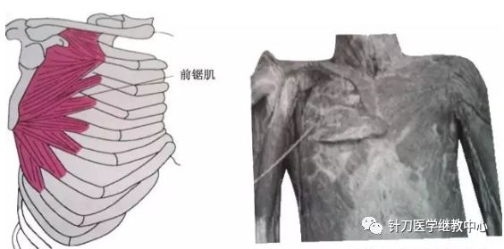 外展枕怎么使用干货 ｜ 针刀治疗要点规程定点定位_https://www.jmylbn.com_新闻资讯_第44张