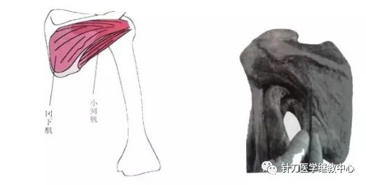 外展枕怎么使用干货 ｜ 针刀治疗要点规程定点定位_https://www.jmylbn.com_新闻资讯_第41张