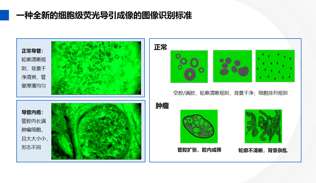 细胞级荧光导引技术亮相第九届慢性乳腺疾病分级诊疗学习班，EndoSCell®引领细胞级精准手术新时代(图4)