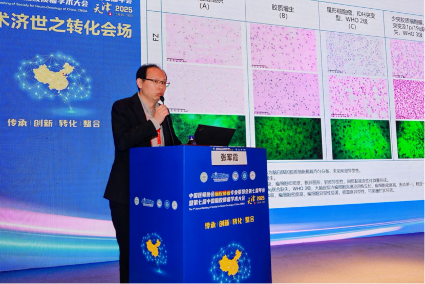 细胞级荧光导引技术临床应用重要里程碑事件：脑肿瘤成像图谱中文版首发！(图6)