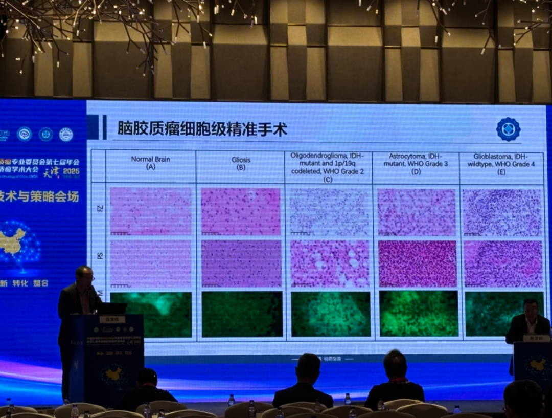 EndoSCell®成为胶质瘤学术年会焦点，八大专家全方位解析细胞级荧光导引技术(图7)