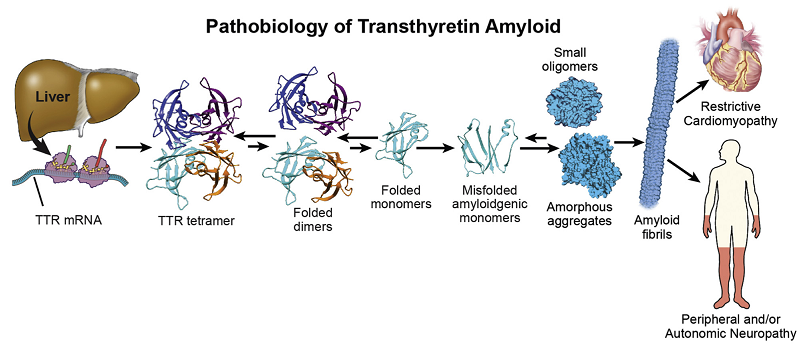 d-spect怎么检查【迎盛会 铸忠诚 强担当 创业绩】我院核医学科成功完成首例^99mTc-PYP心肌淀粉样变SPECT／CT显像_https://www.jmylbn.com_新闻资讯_第4张