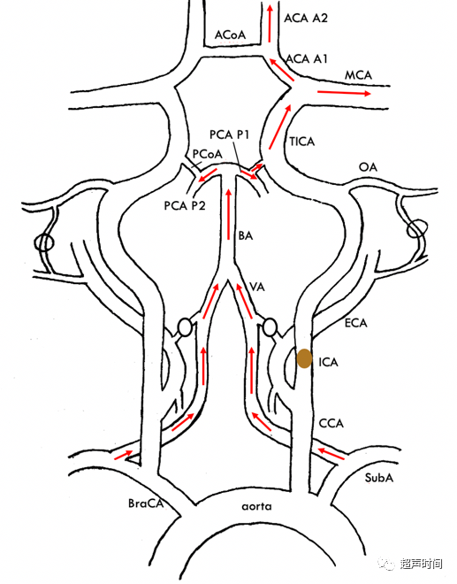 TCD怎么切换探头【血管超声】经颅多普勒（TCD）基础知识及临床应用_https://www.jmylbn.com_新闻资讯_第24张