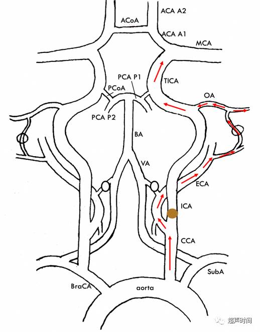 TCD怎么切换探头【血管超声】经颅多普勒（TCD）基础知识及临床应用_https://www.jmylbn.com_新闻资讯_第22张