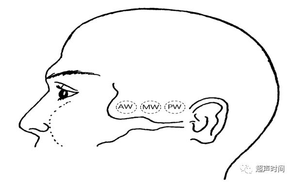 TCD怎么切换探头TCD：经颅多普勒(1-2)：基础知识、检查操作_https://www.jmylbn.com_新闻资讯_第6张