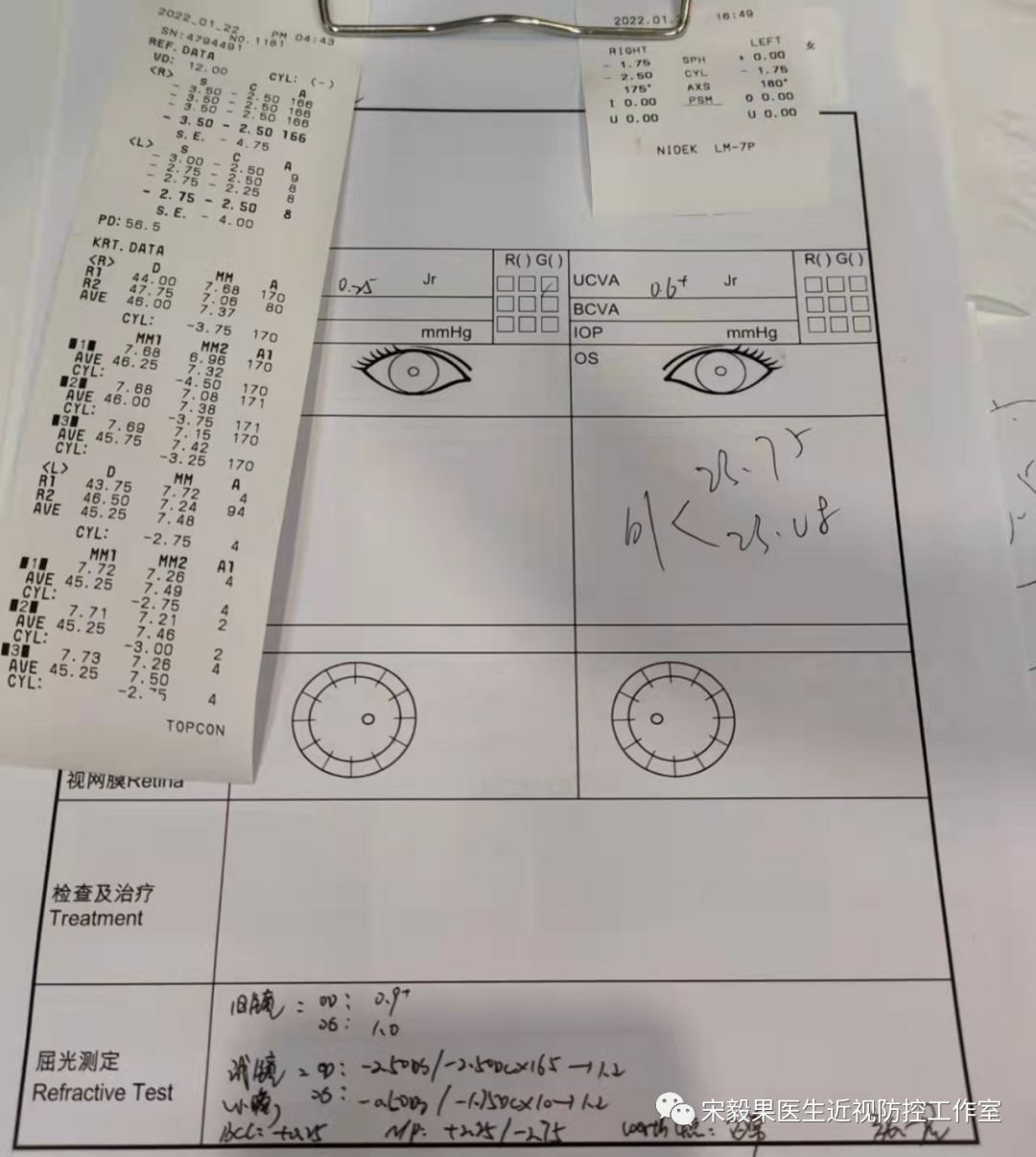 为什么电脑的打mmhg10近视防控直播13--弱视治愈后近视怎么办--近视疯狂在进展，经过治疗得到了控制_https://www.jmylbn.com_新闻资讯_第14张