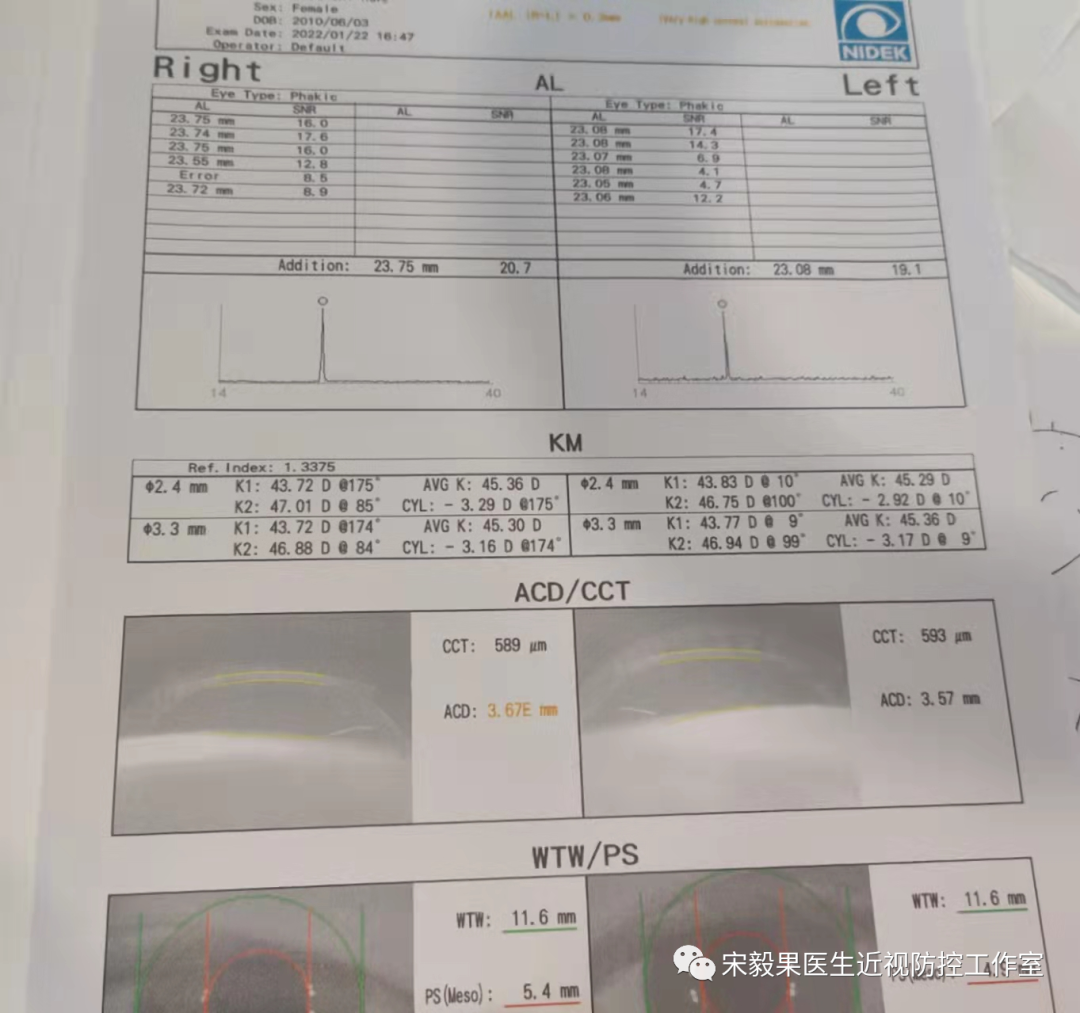 为什么电脑的打mmhg10近视防控直播13--弱视治愈后近视怎么办--近视疯狂在进展，经过治疗得到了控制_https://www.jmylbn.com_新闻资讯_第13张