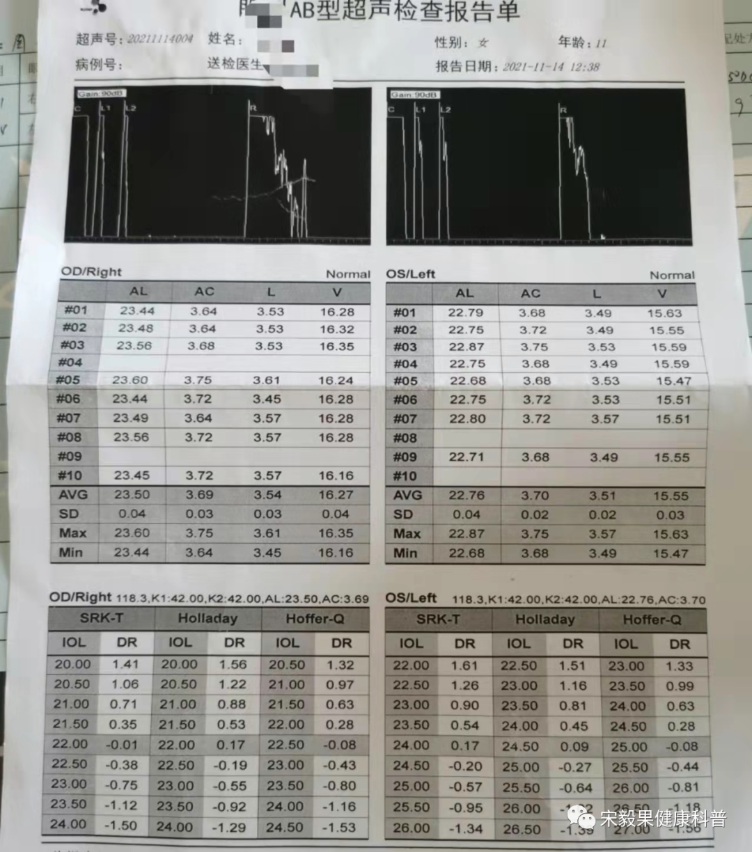 为什么电脑的打mmhg10近视防控直播13--弱视治愈后近视怎么办--近视疯狂在进展，经过治疗得到了控制_https://www.jmylbn.com_新闻资讯_第2张