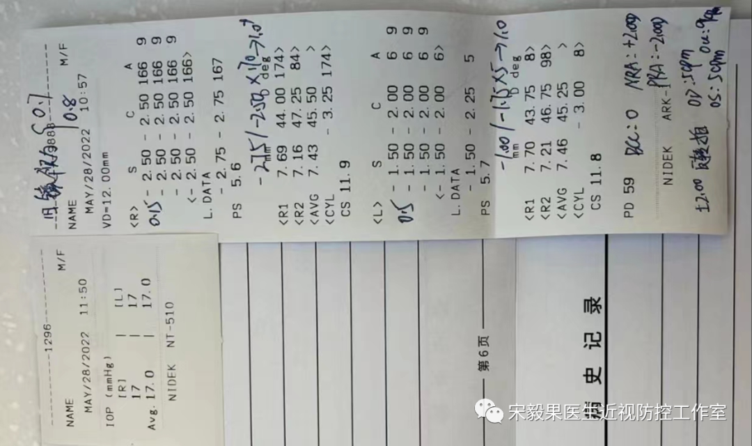 为什么电脑的打mmhg10近视防控直播13--弱视治愈后近视怎么办--近视疯狂在进展，经过治疗得到了控制_https://www.jmylbn.com_新闻资讯_第20张