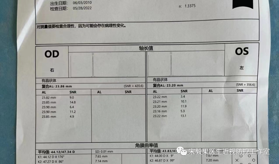 为什么电脑的打mmhg10近视防控直播13--弱视治愈后近视怎么办--近视疯狂在进展，经过治疗得到了控制_https://www.jmylbn.com_新闻资讯_第19张