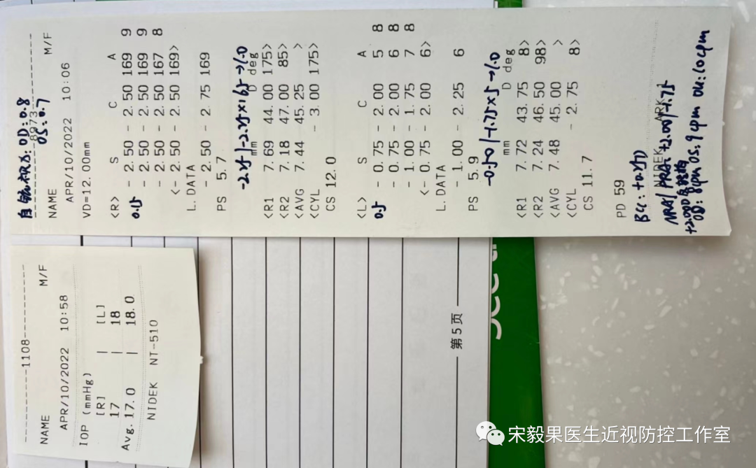 为什么电脑的打mmhg10近视防控直播13--弱视治愈后近视怎么办--近视疯狂在进展，经过治疗得到了控制_https://www.jmylbn.com_新闻资讯_第18张