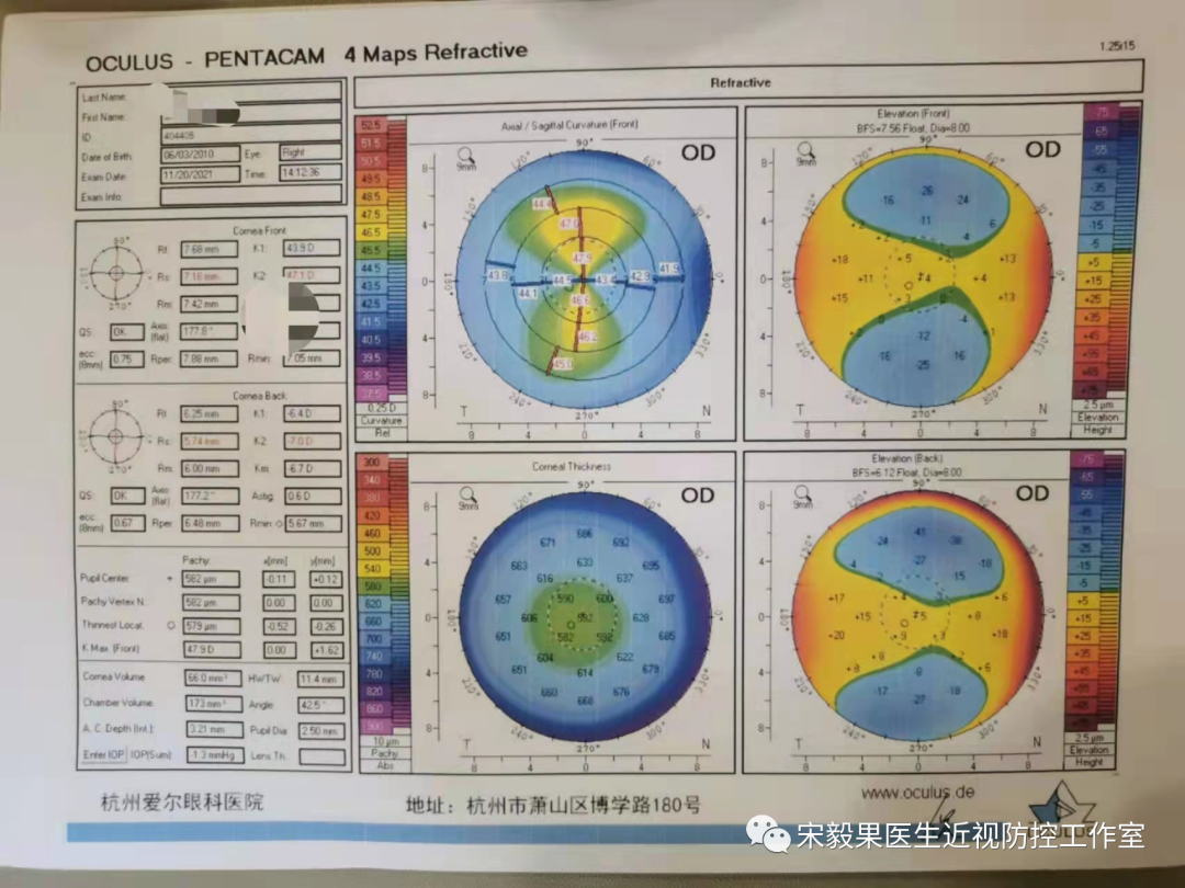 为什么电脑的打mmhg10近视防控直播13--弱视治愈后近视怎么办--近视疯狂在进展，经过治疗得到了控制_https://www.jmylbn.com_新闻资讯_第6张