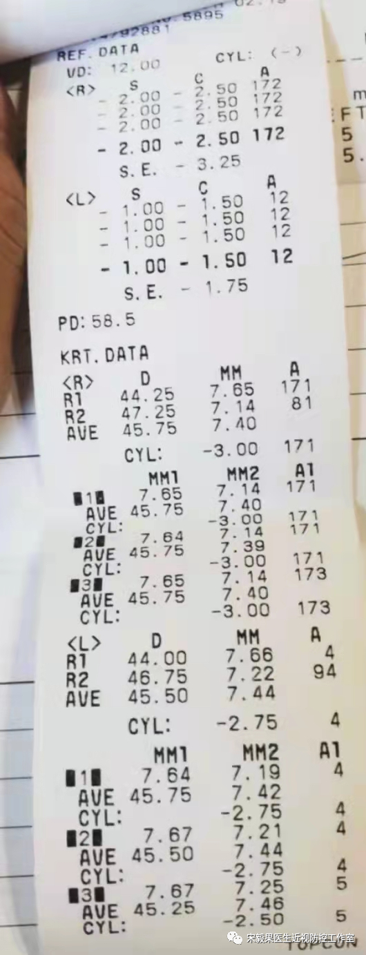 为什么电脑的打mmhg10近视防控直播13--弱视治愈后近视怎么办--近视疯狂在进展，经过治疗得到了控制_https://www.jmylbn.com_新闻资讯_第4张