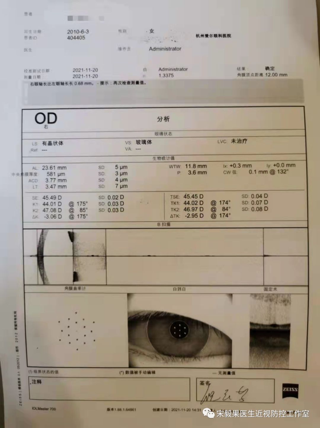 为什么电脑的打mmhg10近视防控直播13--弱视治愈后近视怎么办--近视疯狂在进展，经过治疗得到了控制_https://www.jmylbn.com_新闻资讯_第8张