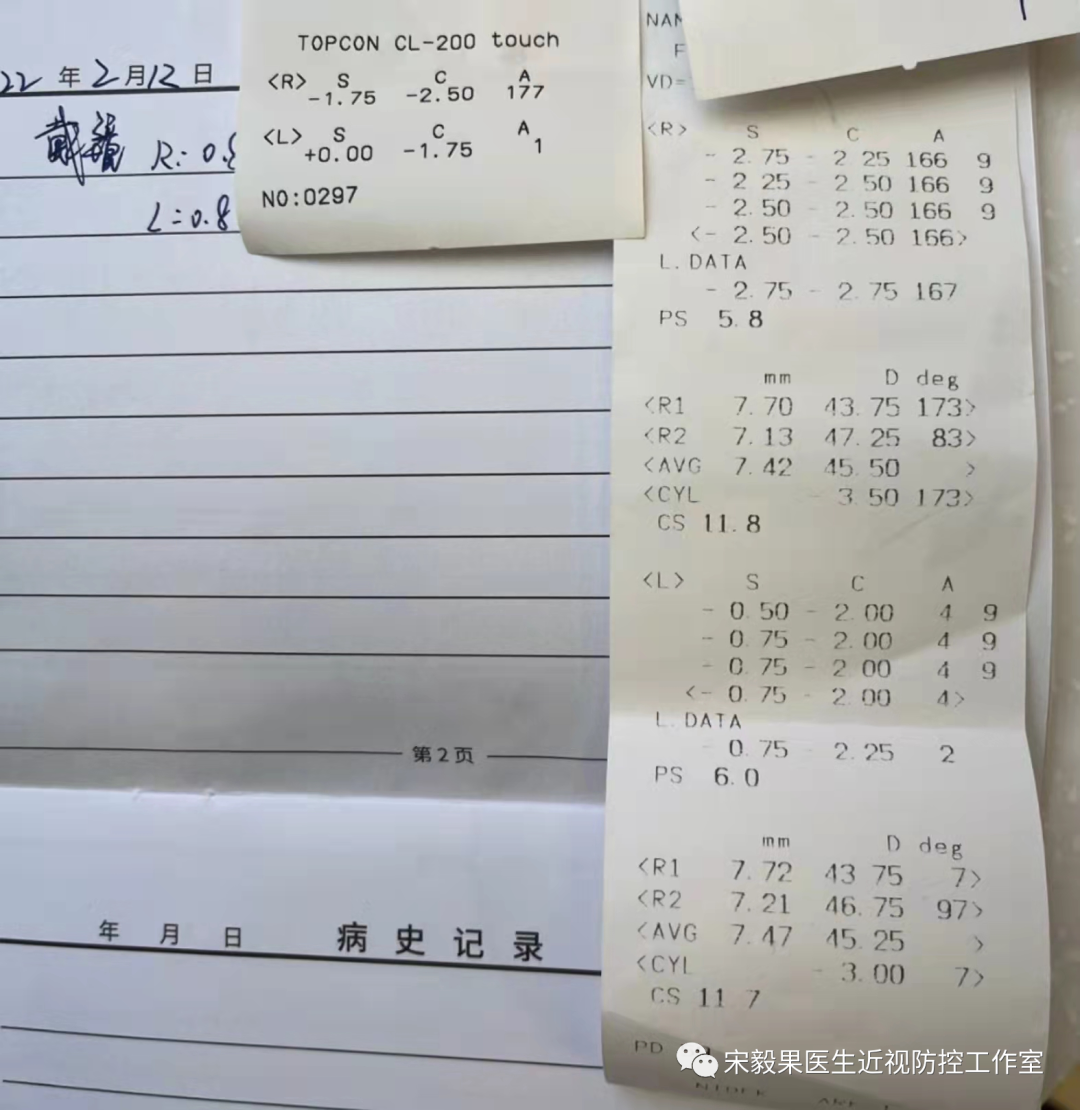 为什么电脑的打mmhg10近视防控直播13--弱视治愈后近视怎么办--近视疯狂在进展，经过治疗得到了控制_https://www.jmylbn.com_新闻资讯_第16张