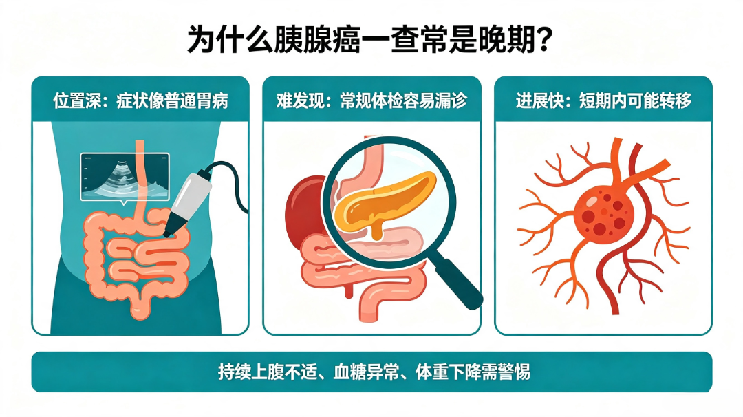 胰腺癌晚期原因及信号 (1).png
