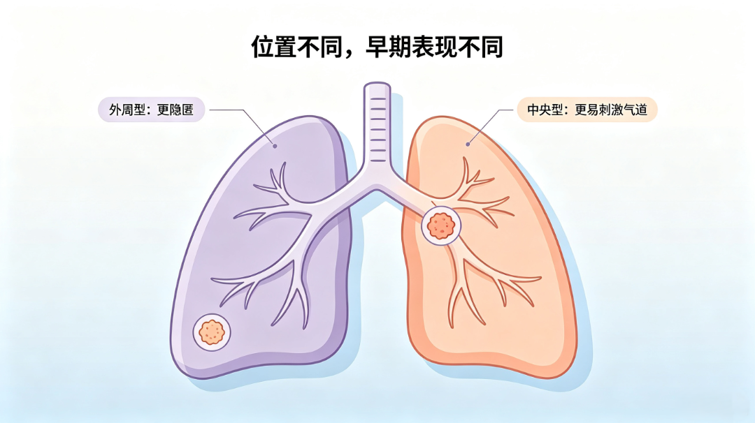 都是肺癌，一个长在“外周”，一个长在“中央”——肺腺癌和肺鳞癌谁更难治？.png