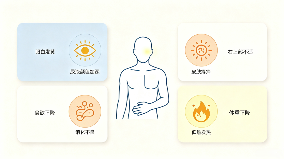 胆管癌早期发现难及信号 (4).png