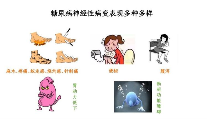 周围神经检测仪有哪些糖尿病周围神经检测仪 让治疗不再复杂_https://www.jmylbn.com_新闻资讯_第2张