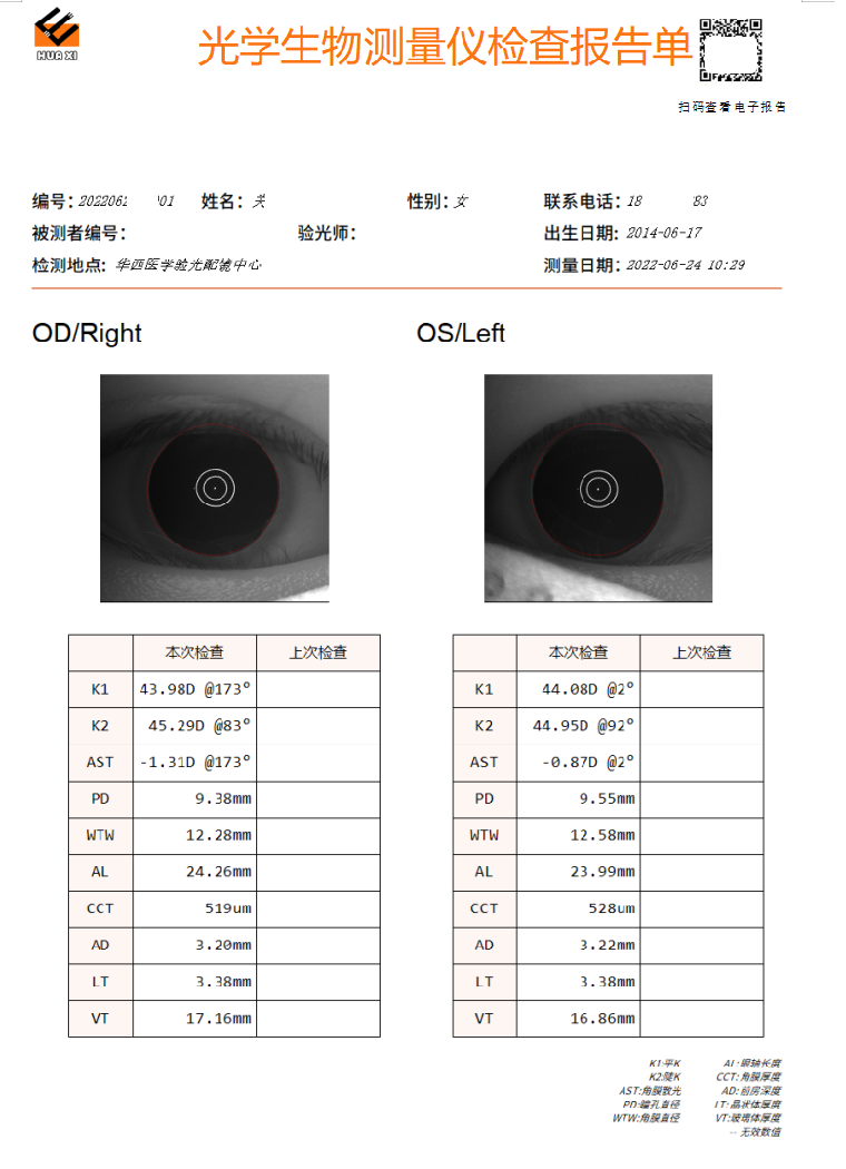 怎么测角膜直径一文教你看懂眼轴（光学生物测量）报告！_https://www.jmylbn.com_新闻资讯_第3张