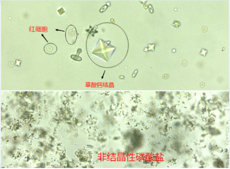 三联磷酸盐结晶图片图片