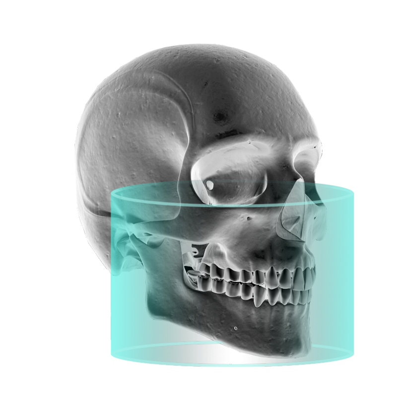 口腔ct什么牌子好【好物分享】口腔CBCT视野到底重不重要？多大视野最合适？_https://www.jmylbn.com_新闻资讯_第11张