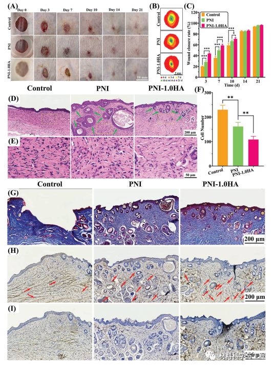 伤口凝胶怎么使用【生物医学】AFM：一种可加速伤口愈合的水凝胶！_https://www.jmylbn.com_新闻资讯_第10张
