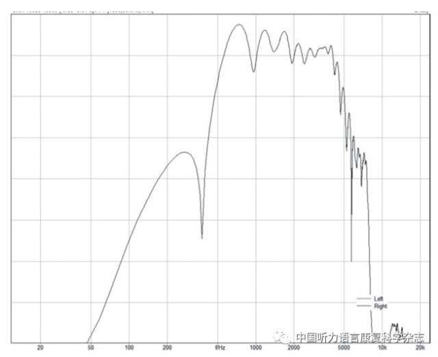 听力学测试中常用的声信号 商丘易声听力旗舰店