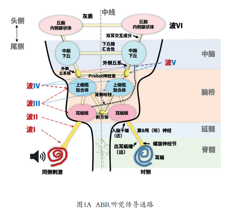 听性脑干反应检查是什么聚焦专题｜2022年第3期临床听力检测技术专题：听性脑干反应临床实践——技术应用到疾病诊断_https://www.jmylbn.com_新闻资讯_第6张