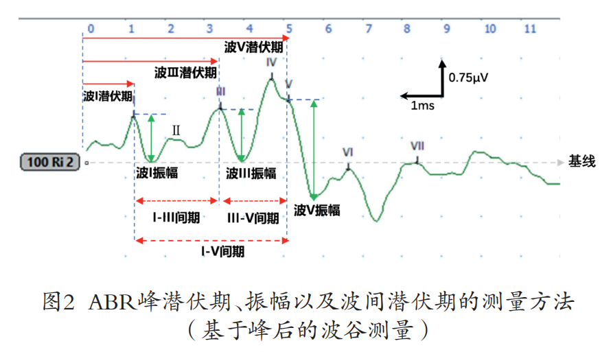 听性脑干反应检查是什么聚焦专题｜2022年第3期临床听力检测技术专题：听性脑干反应临床实践——技术应用到疾病诊断_https://www.jmylbn.com_新闻资讯_第9张