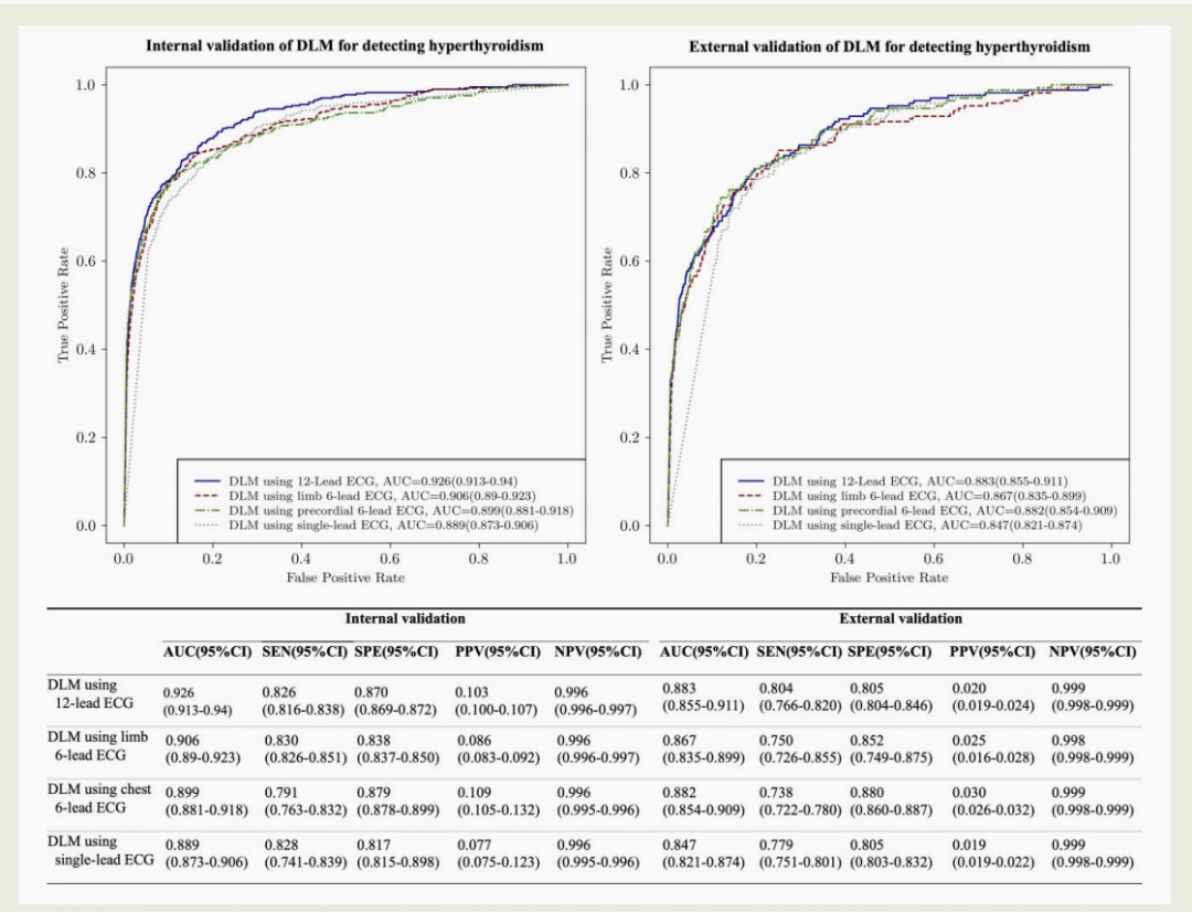 心电图机器怎么看【心闻速递】基于机器学习的心电图生物标志物检测显性甲状腺功能亢进_https://www.jmylbn.com_新闻资讯_第9张