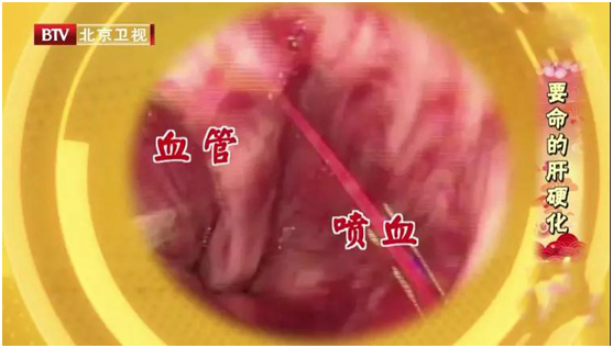 這些疾病可能都是「吃出來」的，近期尤其要小心！損腸胃、毀胰腺、致痛風……別再這樣吃了 健康 第12張