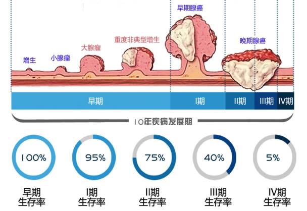 一次腸鏡可保5年平安！50歲以上的人更該格外注意！ 健康 第4張