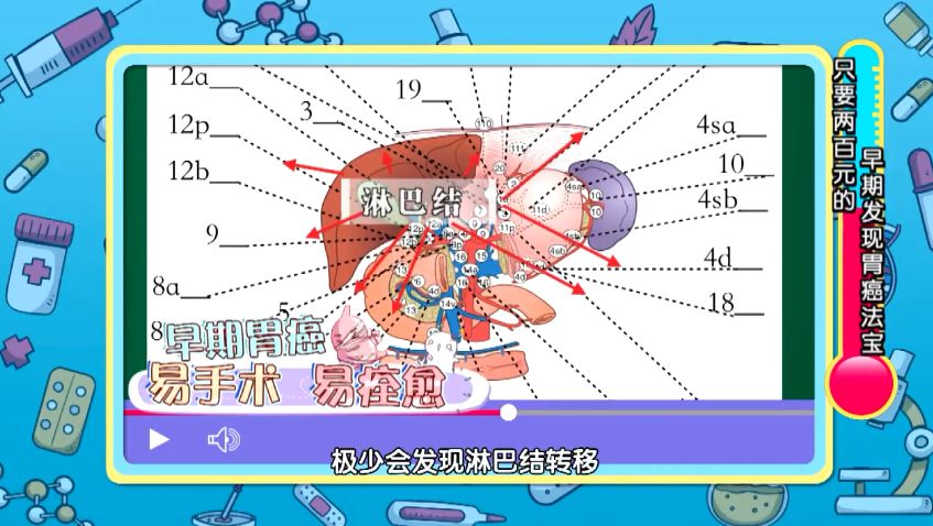 「拉肚子」竟然查出胃癌晚期？日常兩件事太傷胃，要少做！ 健康 第22張