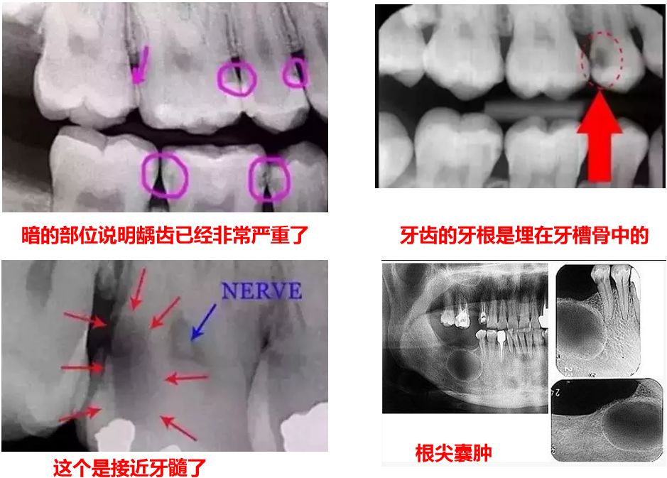 口腔ct怎么看看牙为什么要进行口腔CT检查？不想花这笔钱？_https://www.jmylbn.com_新闻资讯_第11张