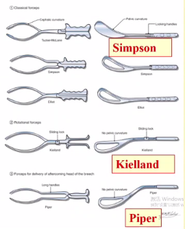kielland产钳怎么翻译每周一课 ｜ 你所需要的阴道助产技术点，都在这里_https://www.jmylbn.com_新闻资讯_第3张