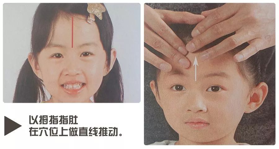 孩子感冒反反复复总不好，中医小儿推拿方法学起来.