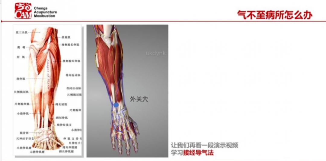导什么针什么气至病所而有效——通过两个穴位领悟导气法_https://www.jmylbn.com_新闻资讯_第3张