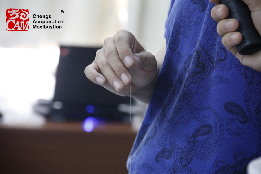 导什么针什么气至病所而有效——通过两个穴位领悟导气法_https://www.jmylbn.com_新闻资讯_第1张