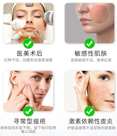 6s加倍美为什么贵加倍美大型医院指定面膜 医用透明质酸皮肤修复敷料_https://www.jmylbn.com_新闻资讯_第14张