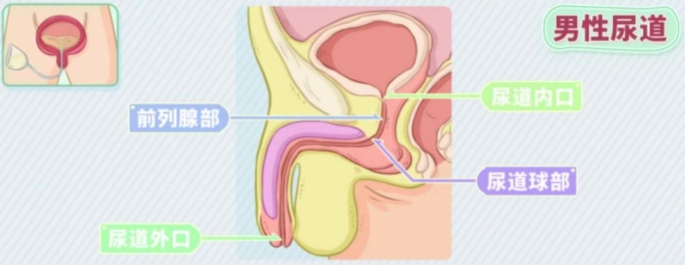 为什么要引流尿袋尿管居家护理科普_https://www.jmylbn.com_新闻资讯_第10张