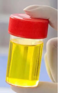 为什么要引流尿袋尿管居家护理科普_https://www.jmylbn.com_新闻资讯_第28张