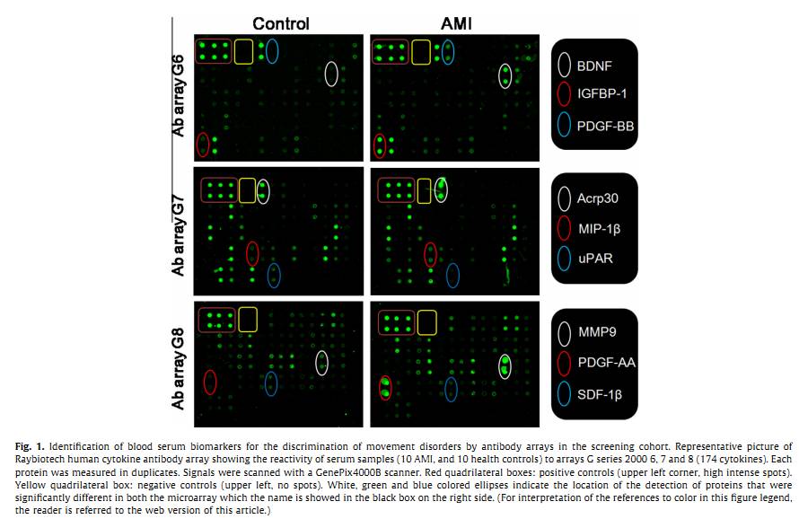 RayBiotech抗体芯片在心肌梗死研究中的应用(图3)