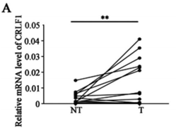 RayBiotech抗体芯片在乳头状甲状腺癌恶化机制研究的应用(图2)