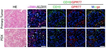 RayBiotech抗体芯片在CAFs与肿瘤耐药性研究中的应用(图6)