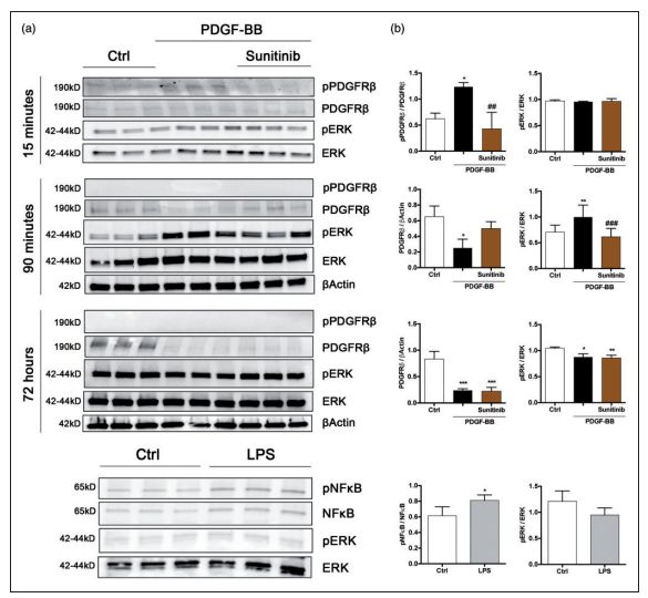 Raybiotech抗体芯片在周细胞响应血小板衍生的PDGF-BB分泌促再生分子研究中的应用(图6)