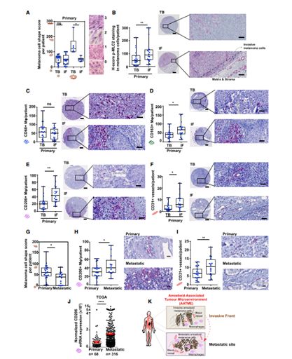 RayBiotech抗体芯片在肌球蛋白II通过免疫微环境对肿瘤的进展研究中的应用(图2)
