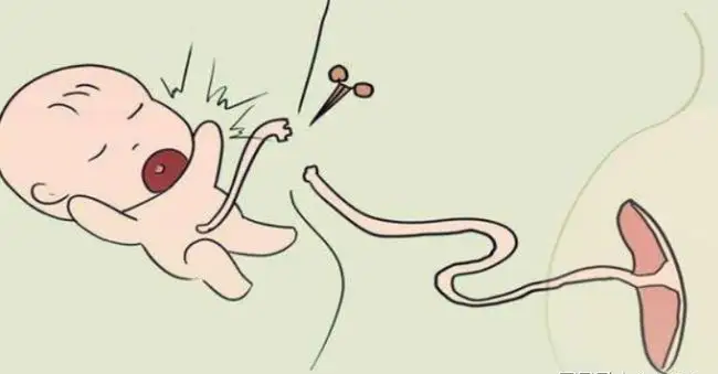 为什么剪脐带要先夹住新手爸妈训练营 ｜ 关于新生儿脐带护理，出生后一个月还不脱落正常吗？需要剪掉吗？_https://www.jmylbn.com_新闻资讯_第6张