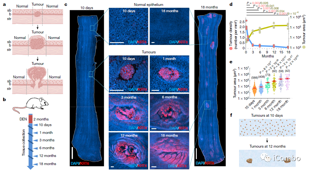 上皮细胞用什么染色博士解读 ｜ 正常上皮细胞突变克隆竞争和清除新生肿瘤细胞克隆_https://www.jmylbn.com_新闻资讯_第5张